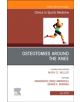 Osteotomies Around the Knee, An Issue of Clinics in Sports Medicine - 9780323682077-thumb