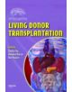 Living Donor Transplantation - 9780849337666-thumb