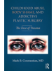 Childhood Abuse, Body Shame, and Addictive Plastic Surgery - 9781138100312-thumb