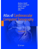 Atlas of Cardiovascular Computed Tomography - 9781447174332-thumb