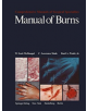 Manual of Burns - 9781461263005-thumb