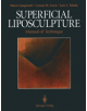 Superficial Liposculpture - 9781461393047-thumb