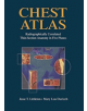 Chest Atlas - 9781461393139-thumb