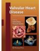 Valvular Heart Disease - 9781617796364-thumb