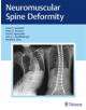 Neuromuscular Spine Deformity - 9781626232600-thumb