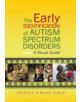 The Early Identification of Autism Spectrum Disorders - 9781849053297-thumb