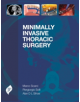 Minimally Invasive Thoracic Surgery - 9781909836402-thumb