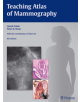 Teaching Atlas of Mammography - Thieme Publishing Group - 9783136408049-thumb