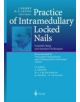 Practice of Intramedullary Locked Nails - 9783540640790-thumb