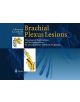 Brachial Plexus Lesions - 9783642635632-thumb