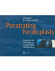 Penetrating Keratoplasty - 9783642640834-thumb