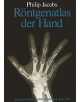 Rontgenatlas der Hand - 9783642658846-thumb