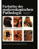 Farbatlas der makroskopischen Pathologie - 9783642663260-thumb