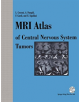 MRI Atlas of Central Nervous System Tumors - Springer Verlag GmbH - 9783709191804-thumb