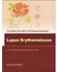 Lupus Erythematosus - 9787117091640-thumb