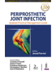 Periprosthetic Joint Infection - 9789352705863-thumb