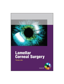 Lamellar Corneal Surgery - 9780071601924