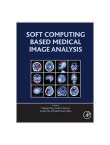 Soft Computing Based Medical Image Analysis - 8107 - 9780128130872