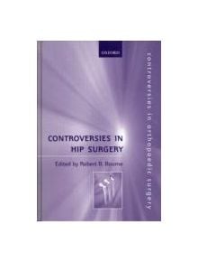 Controversies in Hip Surgery - 9780192631619