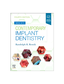 Misch's Contemporary Implant Dentistry - 9780323391559