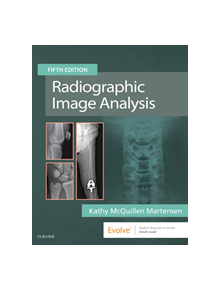 Radiographic Image Analysis - 16494 - 9780323522816