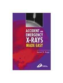 Accident and Emergency X-Rays Made Easy - 9780443073243