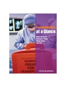 Transplantation at a Glance - 9780470658420