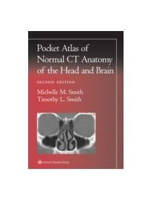 Pocket Atlas of Normal CT Anatomy of the Head and Brain - 9780781729499