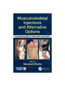 Musculoskeletal Injections and Alternative Options - 9780815355540