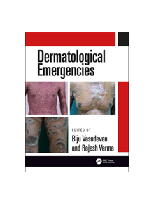 Dermatological Emergencies - 9780815378075