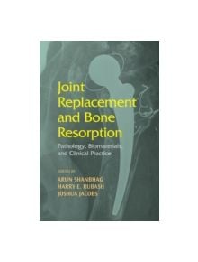 Joint Replacement and Bone Resorption - 9780824729547