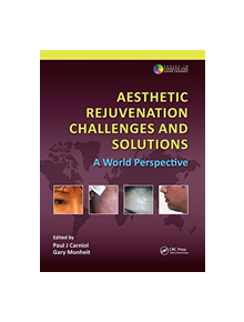 Aesthetic Rejuvenation Challenges and Solutions - 9781138112049