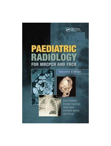 Paediatric Radiology for MRCPCH and FRCR, Second Edition - 9781138372887