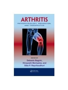 Arthritis - 9781439816868