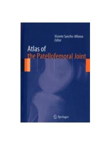 Atlas of the Patellofemoral Joint - 9781447144946