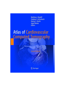 Atlas of Cardiovascular Computed Tomography - 9781447174332