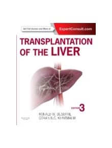 Transplantation of the Liver - 9781455702688