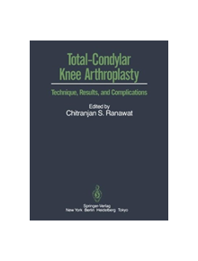 Total-Condylar Knee Arthroplasty - 9781461295419