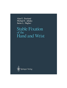 Stable Fixation of the Hand and Wrist - 9781461386421