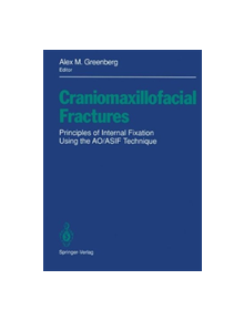 Craniomaxillofacial Fractures - 9781461392897