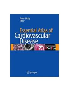 Essential Atlas of Cardiovascular Disease - 9781493950485