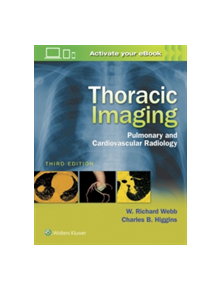 Thoracic Imaging - 9781496321046