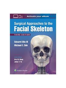 Surgical Approaches to the Facial Skeleton - 9781496380418