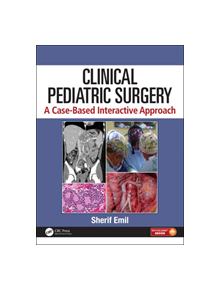 Clinical Pediatric Surgery - 9781498710336