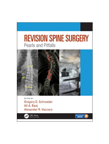 Revision Spine Surgery - 9781498773829