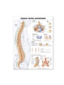 Human Spine Disorders Anatomical Chart - 9781587793998