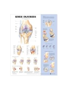 Knee Injuries Anatomical Chart - 9781587797569