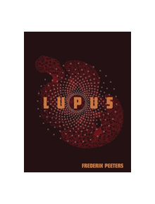 Lupus - 9781603094597