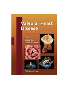 Valvular Heart Disease - 9781617796364