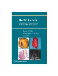 Rectal Cancer - 9781617796951